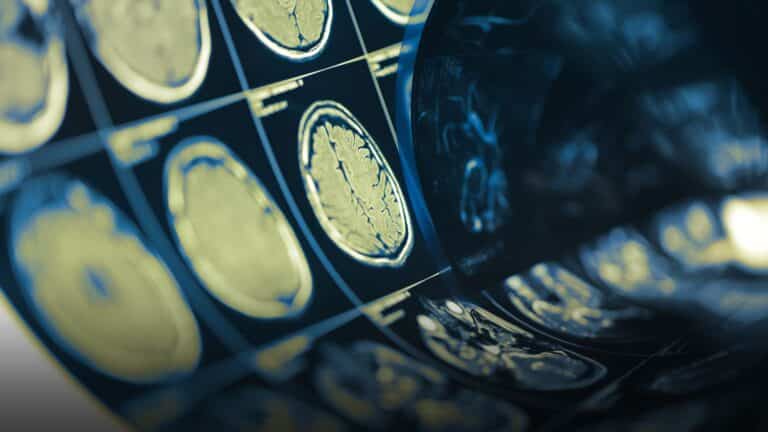 Human Brain Scan Testing Film Folded in a Roll, Medical Backgroud